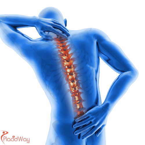 Cirugia de Columna in der Türkei: Kosten und Kliniken